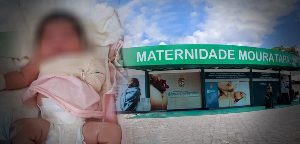 Recém-Nascido da Etnia Tikuna Sofre Fratura na Clavícula Durante Parto em Manaus