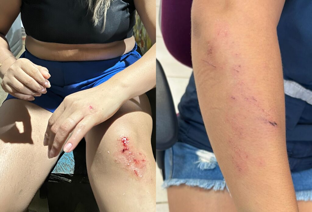 Técnica de Saúde Sofre Ataque na Terra Yanomami; Ministério Evacua Equipe Técnica de Saúde Sofre Ataque na Terra Yanomami; Ministério Evacua Equipe